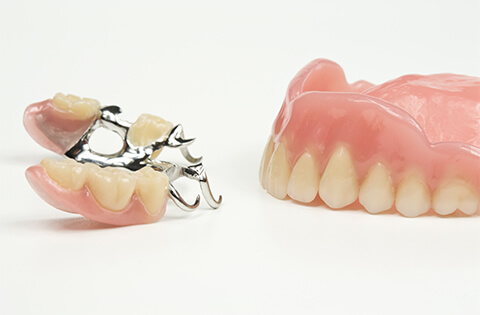 入れ歯治療